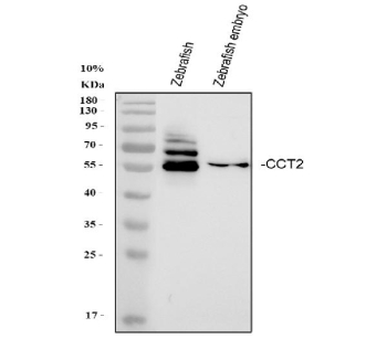Zebrafish Cct2 Antibody WB. Western blot analysis of Zebrafish Cct2 protein using Zebrafish Cct2 antibody and 1) whole zebrafish and 2) zebrafish embryo lysate. Predicted molecular weight ~58 kDa.