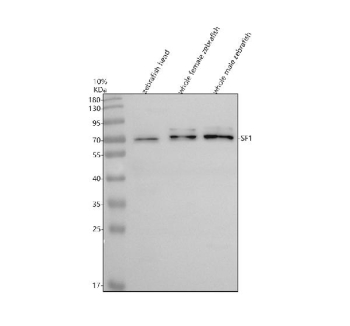 Zebrafish Sf1 Antibody WB. Western blot analysis of Sf1 protein using Zebrafish Sf1 antibody and 1) zebrafish head, 2) whole female zebrafish and 3) whole male zebrafish tissue lysate. Predicted molecular weight ~68 kDa.