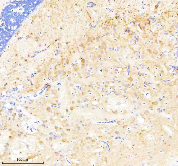 Zebrafish Cask Antibody Brain IHC. Immunohistochemical analysis of Cask protein using Zebrafish Cask antibody and paraffin-embedded zebrafish brain tissue. HIER: boil tissue sections in pH8 EDTA for 20 min and allow to cool before testing.