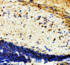 Zebrafish ILF2 Antibody Brain IHC. Immunohistochemistry staining of FFPE human brain tissue with Zebrafish ILF2 antibody. HIER: boil tissue sections in pH8 EDTA for 20 min and allow to cool before testing.