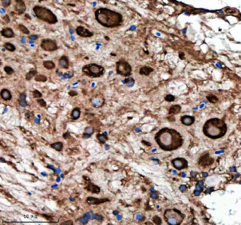 Zebrafish Metap2 Antibody Spinal Cord IHC. Immunohistochemical analysis of Metap2a/b protein using Zebrafish Metap2 antibody and paraffin-embedded zebrafish spinal cord tissue. HIER: boil tissue sections in pH8 EDTA for 20 min and allow to cool before testing.