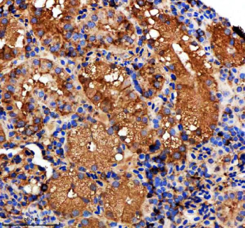 Zebrafish Metap2 Antibody Kidney IHC. Immunohistochemical analysis of Metap2a/b protein using Zebrafish Metap2 antibody and paraffin-embedded zebrafish kidney tissue. HIER: boil tissue sections in pH8 EDTA for 20 min and allow to cool before testing.