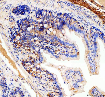 Zebrafish Eif4a2 Antibody Colon IHC. Immunohistochemistry staining of FFPE zebrafish colon tissue with Zebrafish Eif4a2 antibody. HIER: boil tissue sections in pH8 EDTA for 20 min and allow to cool before testing.