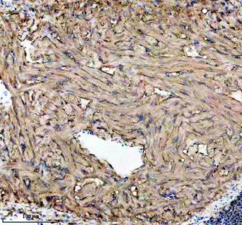 Zebrafish Gls Antibody Heart IHC. Immunohistochemistry staining of FFPE zebrafish heart tissue with Zebrafish Gls antibody. HIER: boil tissue sections in pH8 EDTA for 20 min and allow to cool before testing.