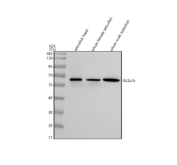Zebrafish Gls Antibody WB. Western blot analysis of Glsa/b protein using Zebrafish Gls antibody and 1) zebrafish head, 2) whole female zebrafish and 3) whole male zebrafish tissue lysate. Predicted molecular weight: ~ ~36 kDa (isoform a) and ~63 kDa (isoform b).