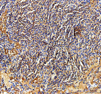 Zebrafish Ckm Antibody Spleen IHC. Immunohistochemistry staining of FFPE zebrafish spleen tissue with Zebrafish Ckm antibody. HIER: boil tissue sections in pH8 EDTA for 20 min and allow to cool before testing.