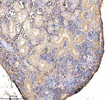 Zebrafish Ckm Antibody Kidney IHC. Immunohistochemistry staining of FFPE zebrafish kidney tissue with Zebrafish Ckm antibody. HIER: boil tissue sections in pH8 EDTA for 20 min and allow to cool before testing.