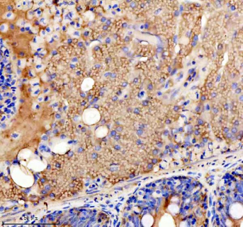Zebrafish Ckm Antibody Pancreas IHC. Immunohistochemistry staining of FFPE zebrafish pancreas tissue with Zebrafish Ckm antibody. HIER: boil tissue sections in pH8 EDTA for 20 min and allow to cool before testing.