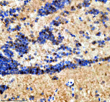 Zebrafish Suz12 Antibody Brain IHC. Immunohistochemical analysis of Suz12a/b protein using Zebrafish Suz12 antibody and paraffin-embedded zebrafish brain tissue. HIER: boil tissue sections in pH8 EDTA for 20 min and allow to cool before testing.