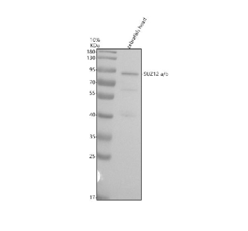 Zebrafish Suz12 Antibody WB. Western blot analysis of Suz12a/b protein using Zebrafish Suz12 antibody and zebrafish head tissue lysate. The predicted molecular weight of Suz12 is ~75 kDa (isoform a) and ~78 kDa (isoform b), commonly observed at 83-95 kDa.
