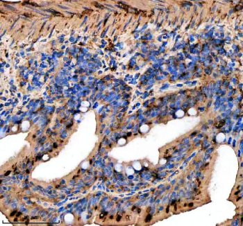 Zebrafish Rab3Gap1 Antibody Colon IHC. Immunohistochemistry staining of FFPE zebrafish colon tissue with Zebrafish Rab3Gap1 antibody. HIER: boil tissue sections in pH8 EDTA for 20 min and allow to cool before testing.