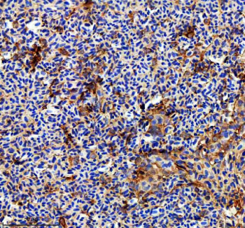 Zebrafish Rab3Gap1 Antibody Spleen IHC. Immunohistochemistry staining of FFPE zebrafish liver tissue with Zebrafish Rab3Gap1 antibody. HIER: boil tissue sections in pH8 EDTA for 20 min and allow to cool before testing.