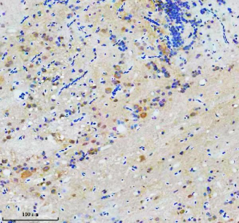 Zebrafish Cct7 Antibody Brain IHC. Immunohistochemical analysis of Cct7 protein using Zebrafish Cct7 antibody and paraffin-embedded zebrafish brain tissue. HIER: boil tissue sections in pH8 EDTA for 20 min and allow to cool before testing.