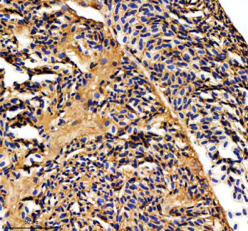 Zebrafish Mat2a Antibody Heart IHC. Immunohistochemistry staining of FFPE zebrafish heart tissue with Zebrafish Mat2a antibody. HIER: boil tissue sections in pH8 EDTA for 20 min and allow to cool before testing.