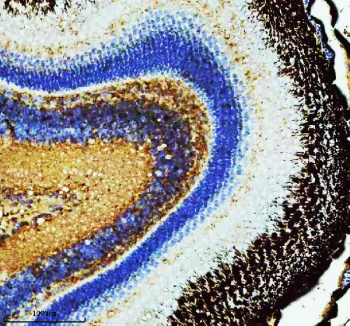 Zebrafish Ppp2ca Antibody Retina IHC. Immunohistochemistry staining of FFPE zebrafish retina tissue with Ppp2ca antibody, HRP secondary and DAB substrate. HIER: boil tissue sections in pH8 EDTA for 20 min and allow to cool before testing.