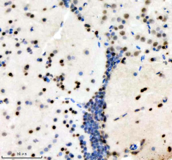 Zebrafish Histone H3 Antibody Brain IHC. Immunohistochemistry staining of FFPE zebrafish brain tissue with Zebrafish Histone H3 antibody. HIER: boil tissue sections in pH8 EDTA for 20 min and allow to cool before testing.