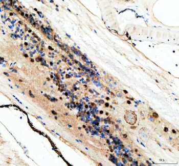Zebrafish Dhx9 Antibody Eye IHC. Immunohistochemical analysis of Dhx9 protein using Zebrafish Dhx9 antibody and paraffin-embedded zebrafish eye tissue. HIER: boil tissue sections in pH8 EDTA for 20 min and allow to cool before testing.