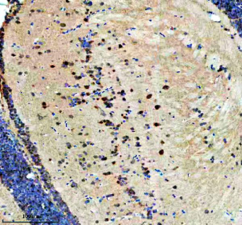 Zebrafish Dhx9 Antibody Brain IHC. Immunohistochemical analysis of Dhx9 protein using Zebrafish Dhx9 antibody and paraffin-embedded zebrafish brain tissue. HIER: boil tissue sections in pH8 EDTA for 20 min and allow to cool before testing.