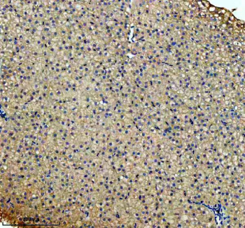 Zebrafish Cbs Antibody Liver IHC. Immunohistochemistry staining of FFPE zebrafish liver tissue with Zebrafish Cbs antibody. HIER: boil tissue sections in pH8 EDTA for 20 min and allow to cool before testing.