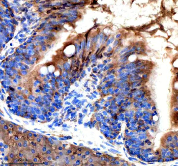 Zebrafish Srsf3 Antibody Colon IHC. Immunohistochemistry staining of FFPE zebrafish colon tissue with Zebrafish Srsf3 antibody. HIER: boil tissue sections in pH8 EDTA for 20 min and allow to cool before testing.