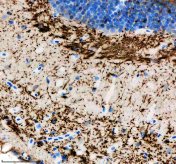 Zebrafish Hras Antibody Brain IHC. Immunohistochemical analysis of Hrasa/b protein using Zebrafish Hras antibody and paraffin-embedded zebrafish brain tissue. HIER: boil tissue sections in pH8 EDTA for 20 min and allow to cool before testing.