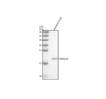 Zebrafish Hras Antibody WB. Western blot analysis of Hrasa/b protein using Zebrafish Hras antibody and zebrafish head tissue lysate. The predicted molecular weight of Hrasa/b is 21 kDa.