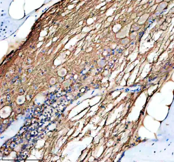 Zebrafish Hras Antibody Spinal Cord IHC. Immunohistochemical analysis of Hrasa/b protein using Zebrafish Hras antibody and paraffin-embedded zebrafish spinal cord tissue. HIER: boil tissue sections in pH8 EDTA for 20 min and allow to cool before testing.