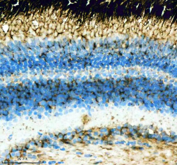 Zebrafish Hras Antibody Eye IHC. Immunohistochemical analysis of Hrasa/b protein using Zebrafish Hras antibody and paraffin-embedded zebrafish eye tissue. HIER: boil tissue sections in pH8 EDTA for 20 min and allow to cool before testing.