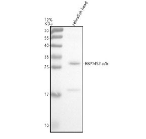 Zebrafish Rbpms2 Antibody WB. Western blot analysis of Rbpms2a/b protein using Zebrafish Rbpms2 antibody and zebrafish head tissue lysate. The predicted molecular weight of Rbpms2a/b is ~22 kDa.