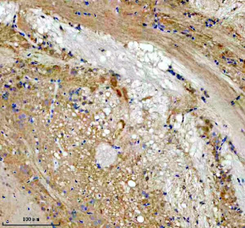 Zebrafish Lzic Antibody Brain IHC. Immunohistochemical analysis of Lzic protein using Zebrafish Lzic antibody and paraffin-embedded zebrafish brain tissue. HIER: boil tissue sections in pH8 EDTA for 20 min and allow to cool before testing.
