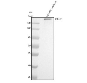 Zebrafish Dicer Antibody WB. Western blot analysis of Dicer protein using Zebrafish Dicer antibody and zebrafish embryo tissue lysate. The predicted molecular weight of Dicer is ~219 kDa.