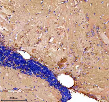 Zebrafish Gabarap Antibody Brain IHC. Immunohistochemistry staining of FFPE zebrafish brain tissue with Zebrafish Gabarap antibody. HIER: boil tissue sections in pH8 EDTA for 20 min and allow to cool before testing.