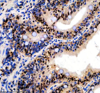 Zebrafish Luc7l3 Antibody Colon IHC. Immunohistochemical analysis of Luc7-like protein 3 using Zebrafish Luc7l3 antibody and paraffin-embedded zebrafish colon tissue. HIER: boil tissue sections in pH8 EDTA for 20 min and allow to cool before testing.