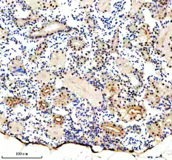 Zebrafish Luc7l3 Antibody Kidney IHC. Immunohistochemical analysis of Luc7-like protein 3 using Zebrafish Luc7l3 antibody and paraffin-embedded zebrafish kidney tissue. HIER: boil tissue sections in pH8 EDTA for 20 min and allow to cool before testing.