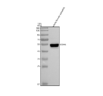 Zebrafish Ddx6 Antibody WB. Western blot analysis of Ddx6 protein using Zebrafish Ddx6 antibody and whole female zebrafish tissue lysate. The predicted molecular weight of Ddx6 is ~54 kDa.