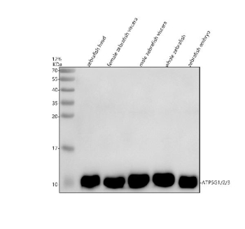 Zebrafish Atp5mc Antibody WB. Western blot analysis of Atp5mc1/2/3 protein using Zebrafish Atp5mc antibody and and 1) zebrafish head, 2) female zebrafish viscera, 3) male zebrafish viscera, 4) whole zebrafish and 5) zebrafish embryo tissue lysate. Predicted molecular weight ~10 kDa.