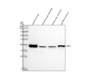 Zebrafish Gipc1 Antibody WB. Western blot analysis of Gipc1 protein using Gipc1 antibody and 1) zebrafish head, 2) whole female zebrafish, 3) whole male zebrafish and 4) zebrafish embryo tissue lysate. Predicted molecular weight ~36 kDa.