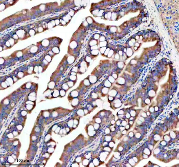Zebrafish Gipc1 Antibody Colon IHC. Immunohistochemistry staining of FFPE zebrafish colon tissue with Zebrafish Gipc1 antibody. HIER: boil tissue sections in pH8 EDTA for 20 min and allow to cool before testing.