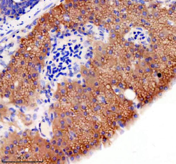 Zebrafish Gephyrin Antibody Pancreas IHC. Immunohistochemical analysis of GPHNa/b protein using Zebrafish Gephyrin antibody and paraffin-embedded zebrafish pancreas tissue. HIER: boil tissue sections in pH8 EDTA for 20 min and allow to cool before testing.