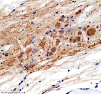 Zebrafish Gephyrin Antibody Spinal Cord IHC. Immunohistochemical analysis of GPHNa/b protein using Zebrafish Gephyrin antibody and paraffin-embedded zebrafish spinal cord tissue. HIER: boil tissue sections in pH8 EDTA for 20 min and allow to cool before testing.