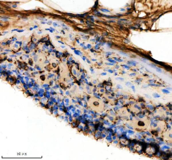 Zebrafish Hprt1 Antibody Integument Tissue IHC. Immunohistochemistry staining of FFPE zebrafish integument tissue with Zebrafish Hprt1 antibody. HIER: boil tissue sections in pH8 EDTA for 20 min and allow to cool before testing.