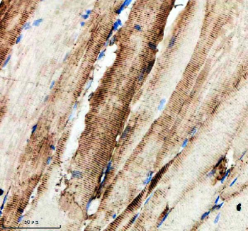 Zebrafish Hprt1 Antibody Muscle Tissue IHC. Immunohistochemistry staining of FFPE zebrafish muscle tissue with Zebrafish Hprt1 antibody. HIER: boil tissue sections in pH8 EDTA for 20 min and allow to cool before testing.