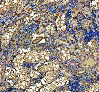 Zebrafish Hprt1 Antibody Kidney Tissue IHC. Immunohistochemistry staining of FFPE zebrafish kidney tissue with Zebrafish Hprt1 antibody. HIER: boil tissue sections in pH8 EDTA for 20 min and allow to cool before testing.