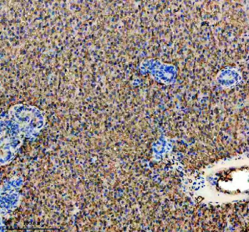 Zebrafish Hprt1 Antibody Liver Tissue IHC. Immunohistochemistry staining of FFPE zebrafish liver tissue with Zebrafish Hprt1 antibody. HIER: boil tissue sections in pH8 EDTA for 20 min and allow to cool before testing.