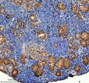 Zebrafish Abce1 Antibody Kidney IHC. Immunohistochemistry staining of FFPE zebrafish kidney tissue with Zebrafish Abce1 antibody, HRP-secondary and DAB substrate. HIER: boil tissue sections in pH8 EDTA for 20 min and allow to cool before testing.