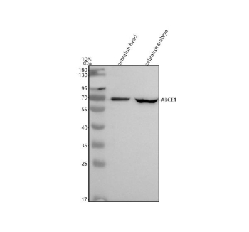 Zebrafish Abce1 Antibody WB. Western blot analysis of ABCE1 protein using Zebrafish Abce1 antibody and zebrafish 1) head and 20 embryo tissue lysate. Predicted molecular weight ~67 kDa.