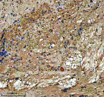 Zebrafish Abce1 Antibody Brain IHC. Immunohistochemistry staining of FFPE zebrafish brain tissue with Zebrafish Abce1 antibody. HIER: boil tissue sections in pH8 EDTA for 20 min and allow to cool before testing.