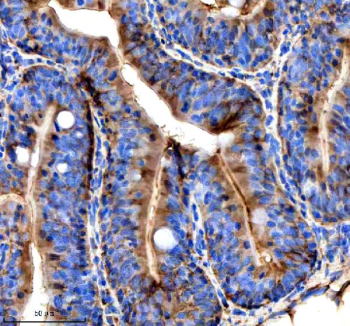 Zebrafish Stip1 Antibody Colon IHC. Immunohistochemical analysis of Stip1 protein using Zebrafish Stip1 antibody and paraffin-embedded zebrafish colon tissue. HIER: boil tissue sections in pH8 EDTA for 20 min and allow to cool before testing.