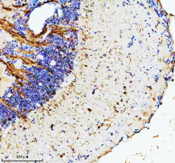 Hprt1 Antibody Brain IHC. Immunohistochemistry staining of FFPE zebrafish brain tissue with Zebrafish Hypoxanthine phosphoribosyltransferase antibody. HIER: boil tissue sections in pH8 EDTA for 20 min and allow to cool before testing.