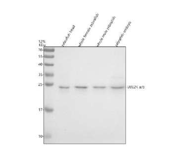 Zebrafish Ube2k Antibody WB. Western blot analysis of UBE2Ka/b protein using Zebrafish Ube2k antibody and 1) zebrafish head, 2) whole female zebrafish, 3) whole male zebrafish and 4) zebrafish embryo tissue lysate. Predicted molecular weight ~22 kDa.